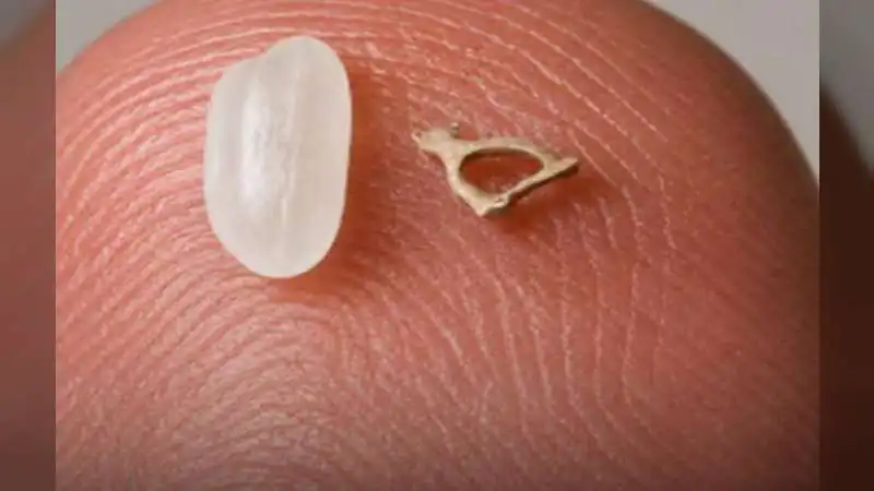 Unveiling the Human Body's Smallest Bone: A Tiny Marvel in Your Ear